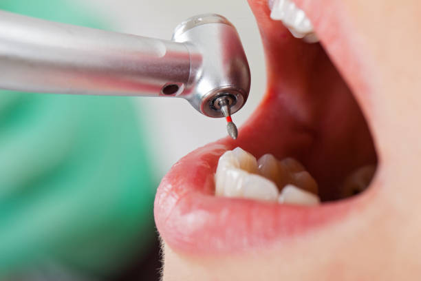 Best Emergency Broken Tooth Repair in Sedgwick, KS